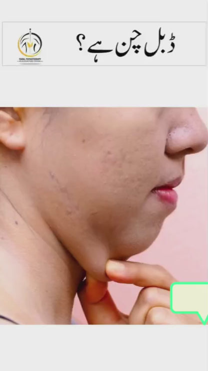 Jawline Lifting & Face Slimming Trainer